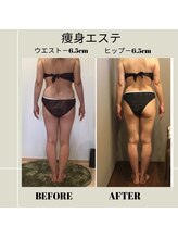 ムーン(MOON)/痩身エステ全身