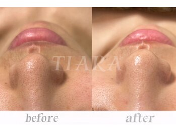 ティアラ 錦糸町(TIARA)/