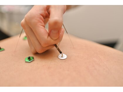 スキャプラ あざみ野荏田店(SCAPULA)の写真