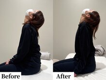 ソレア(Solea)/肩こり・首こり改善1回目