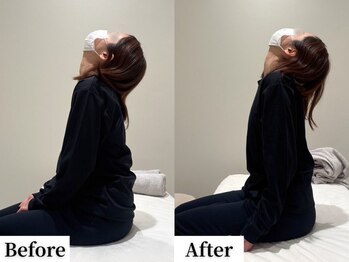 ソレア(Solea)/肩こり・首こり改善1回目