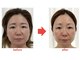 ブプラ 大宮店(BUPURA)の写真