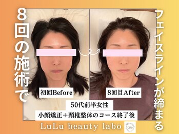 ルルラボ(LuLu beauty labo)の写真/【小顔矯正＆頚椎整体￥3,980】顔の歪み・左右差を首から改善◎