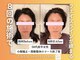 ルルラボ(LuLu beauty labo)の写真/【小顔矯正＆頚椎整体￥3,980】顔の歪み・左右差を首から改善◎