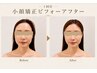 【劇的小顔!人気NO.1】頭蓋骨矯正+骨格小顔マッサージ(美肌パック)75分