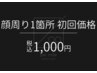 【メンズ脱毛】顔周り(一部ボディ)初回価格　1部位選択1回￥1,000