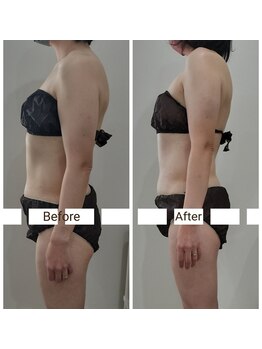 レスプロンディール(Resplendir)/