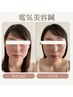 【小顔/噛み締めケア】電気美容鍼+ボディ鍼灸調整80分
