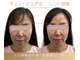 ルソール 銀座(Le seul)の写真
