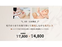 バニスター(Bannister)