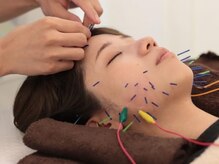 美容整体 リニューサロン 美咲が丘院(renew salon)