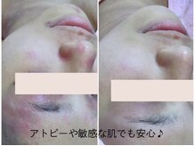 エステティックサロン アールグレー 名古屋駅店/フェイシャルメニュー10種類以上