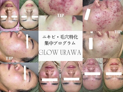 グロウ(GLOW)の写真