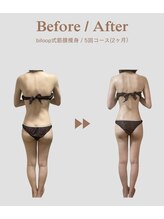 ビループ(biloop)/背中で変わる印象。