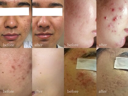 アーネスト 大阪心斎橋店(EARNEST)の写真