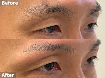眉毛の王様 小倉店/眉毛BA[眉毛/眉毛サロン]