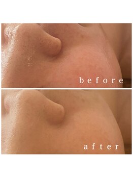 メナードフェイシャルサロン 岐阜茜部/美肌◎