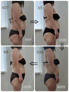 レスプロンディール(Resplendir)/120分全身痩身☆