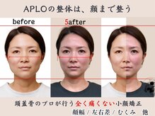アプロ(APLO)