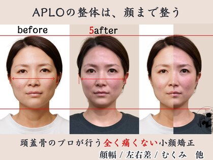 アプロ(APLO)の写真