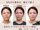 アプロ(APLO)の写真