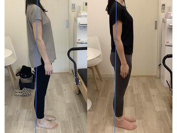 ピラティストトヤセ 神戸元町店/整体×ピラティス半年間の変化◎