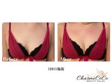 シャルムココ 蔵前店(CharmeCoCo)/お客様Before→After