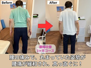 東林間整骨院/腰の痛みで丸まった背骨が伸びた