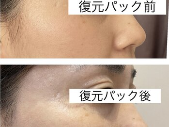 エスデザイン(es design)/ブライダルエステ/フェイシャル