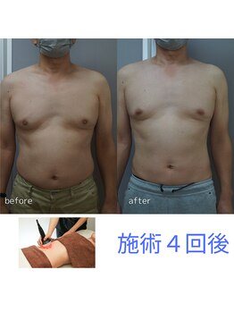 アップルミント/＜痩身＞before・after