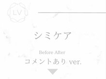 ラヴィオーラ 姫路店(La Viora)/ダイヤモンドハーブピーリング