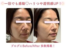 ミサズ スキンケア(misa's skin care)の雰囲気（ツルスベ実感だけでなく、リフトアップ・小顔もご実感頂けます！）