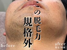 メンズロータス(men's Lotus)