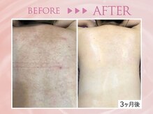 クリアラボ 池袋2nd(Clear Lab)/韓国肌管理&毛穴洗浄専門店