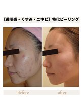 カナウ produced by きょうわ整体院(Kanau.)/《透明感・くすみ・ニキビ》