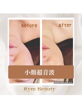 リム ビューティー(RYM BEAUTY)/小顔超音波