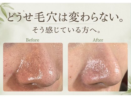 ピネ(pine)の写真