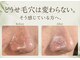 ピネ(pine)の写真