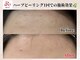 エヌ(N)の写真