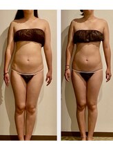 エステティックサロン アンジュ(Ange)/人気の全身コルギ/小顔コルギ