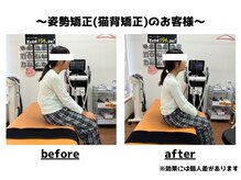 トータルビューティーみつとも/姿勢矯正/猫背矯正