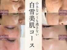 薄いのも濃いのも大きいのも小さいのも全部★シミお任せください