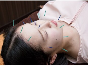 第3なまい接骨院/鍼/同時に美容鍼も対応可◎