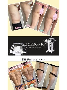 ルミネ(Lumine)/NEW caviZERO+RF デビュー！！