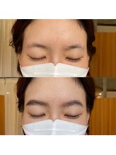 マレ アイデザイン(MARE eyedesign)/ハリウッドブロウリフト