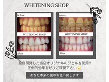 ホワイトニングショップ 刈谷店/【美白ホワイトニング　効果】