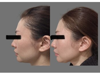 ソナ 大和西大寺院(SONA)/IPL光フェイシャル