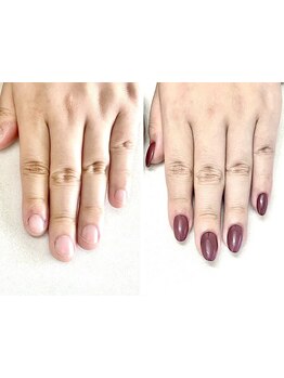 爪の悩みを解消できる（ケア含む）