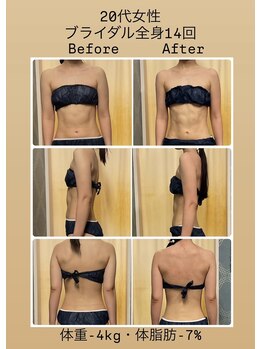 ヌーボ(NUeVo)/本気ブライダル(14回)