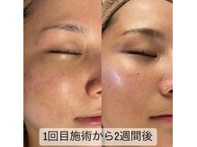 ビズエー(viz.A)/